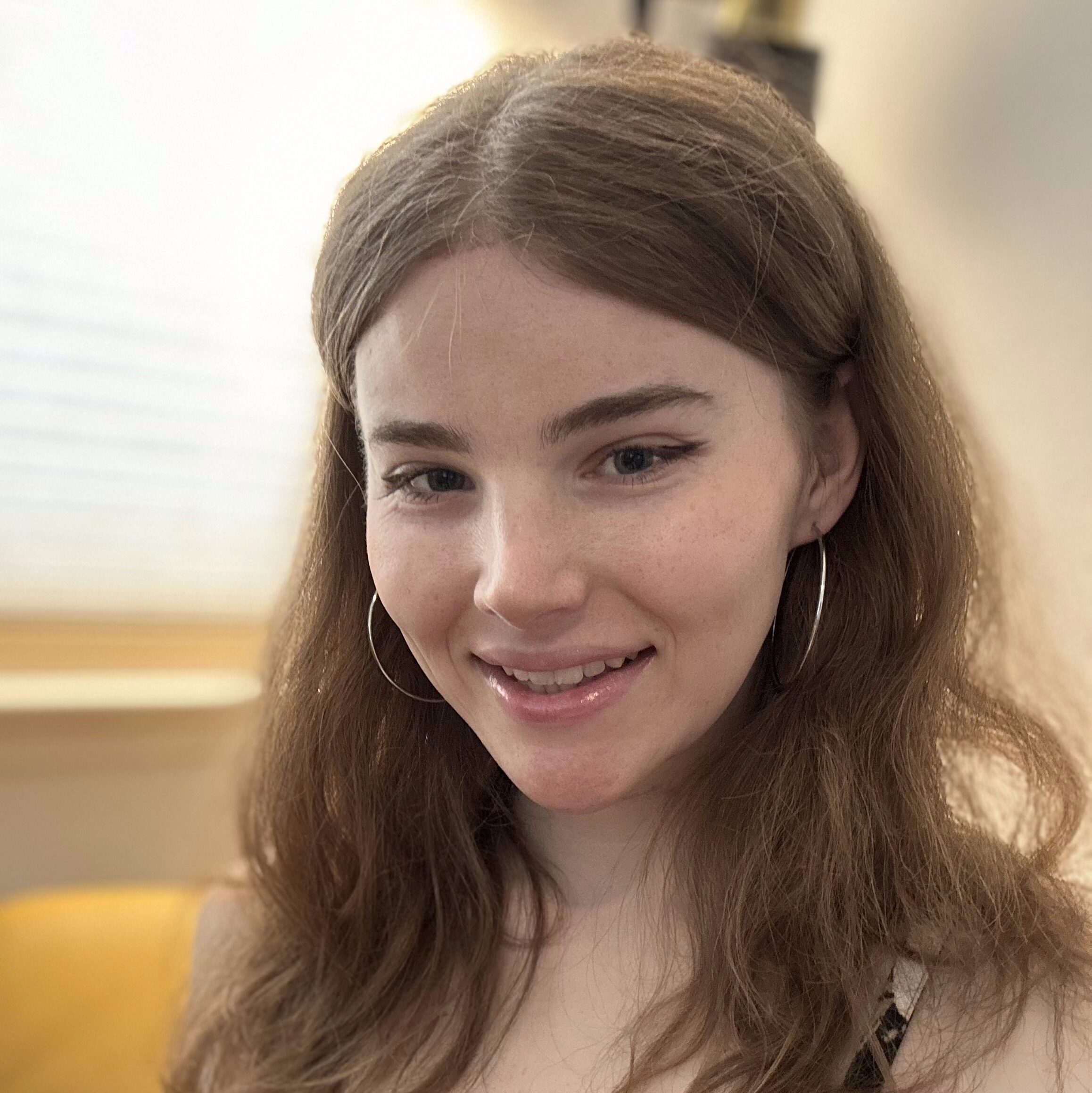 feminizations Facial Feminization in Thousand Oaks, CA | MD Art Plastic Surgery